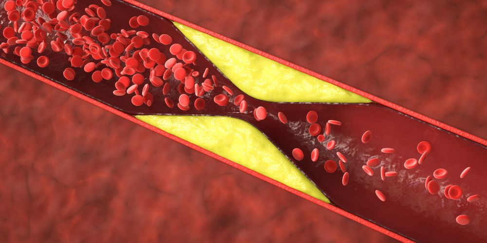 What Are the Warning Signs of Cavernous Sinus Thrombosis?